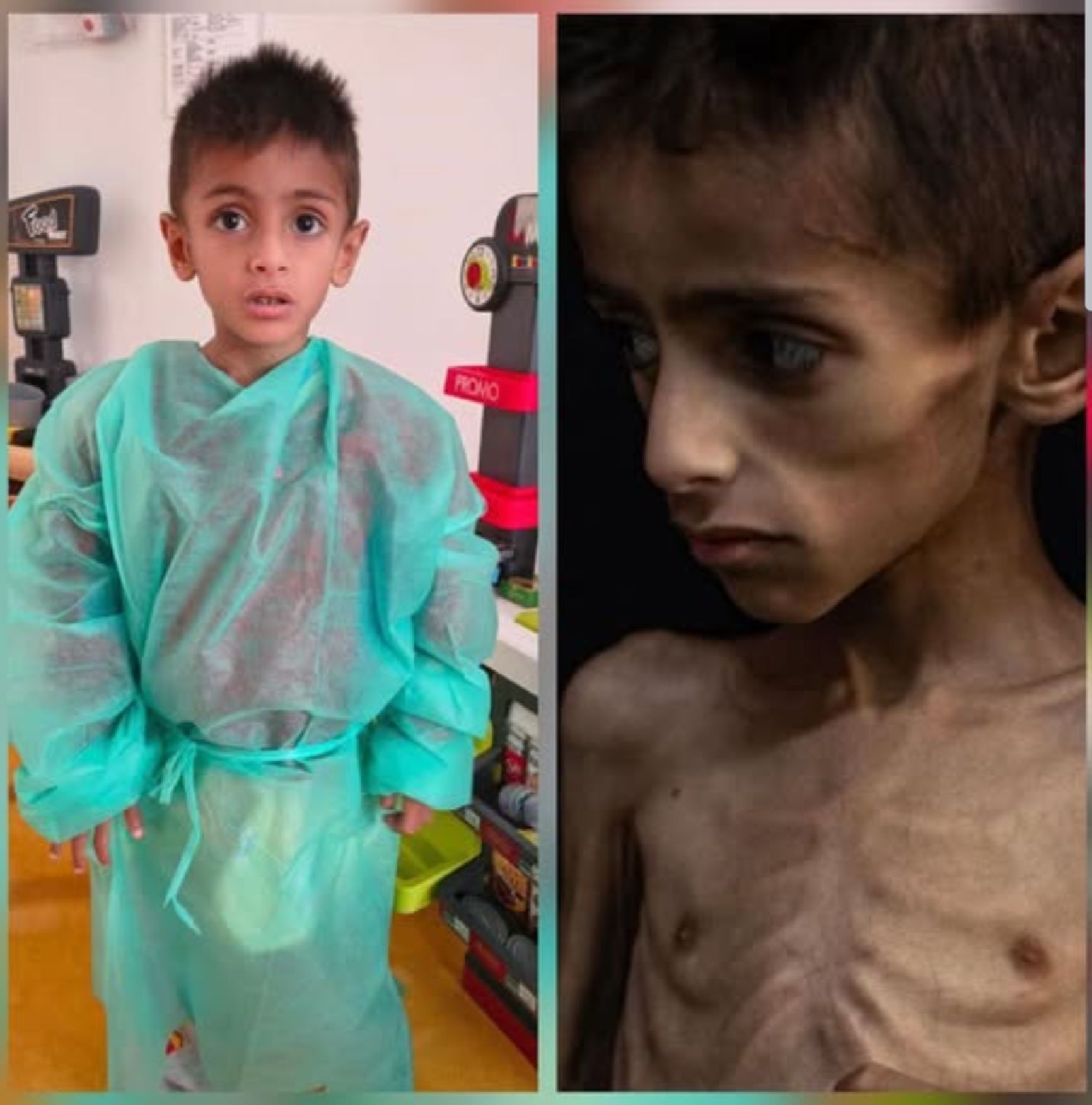 Osama al-Raqab: After and Before Treatment